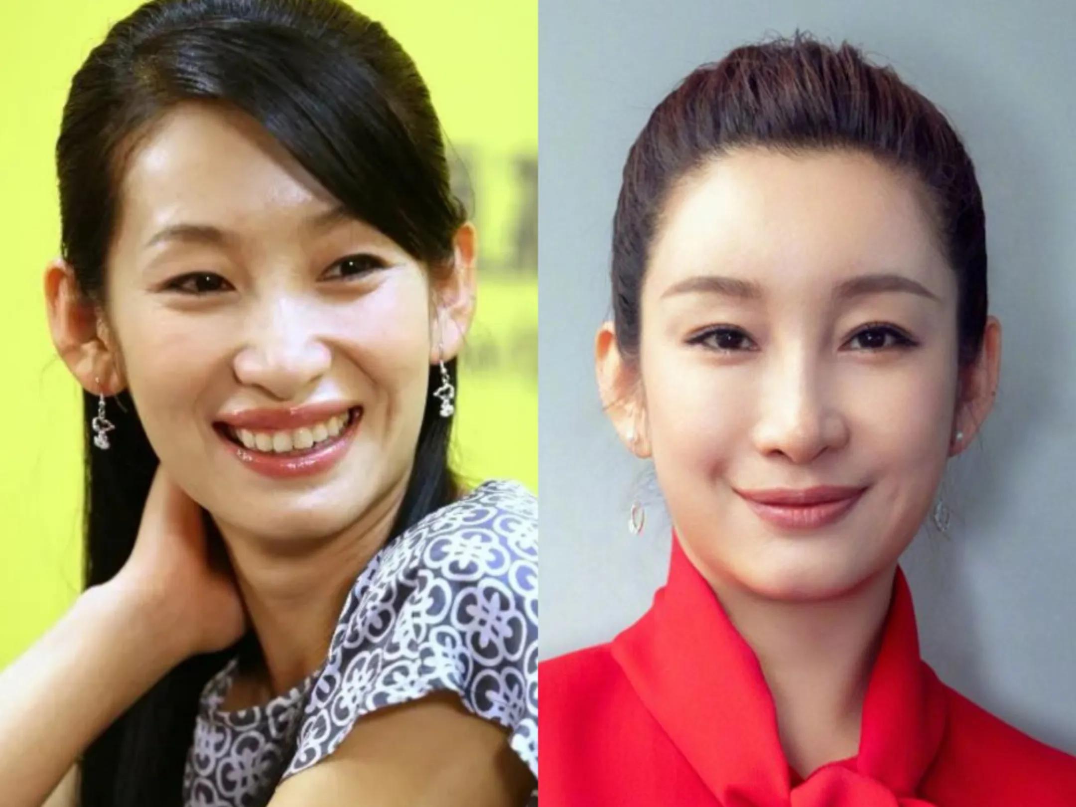 单眼皮女明星_单眼皮美女演技_娱乐圈没有整容过