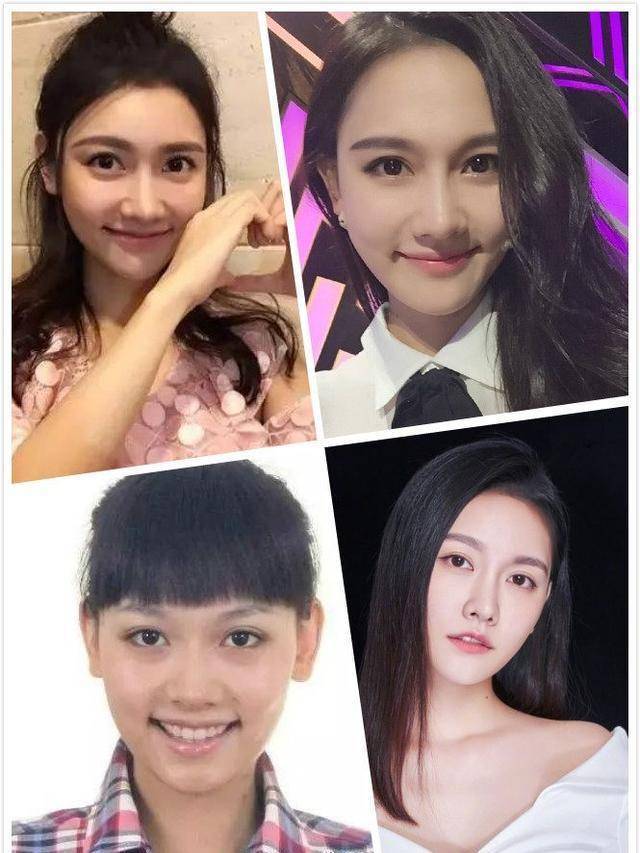 美女整容前后对比_娱乐圈整容美女_混血女明星鼻子