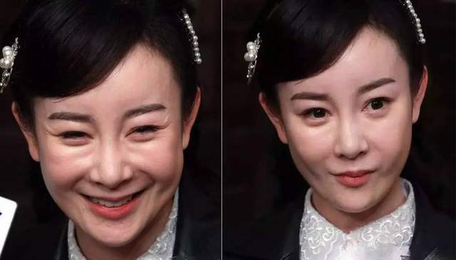 娱乐圈10位被整容毁掉的女星，有人脸僵如石，有的命丧手术台